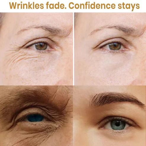 Lutein Anti-Wrinkle Serum 💯 New Younger Skin In days - Image 3